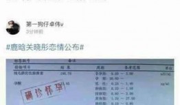 桌伟最新爆料,揭秘娱乐圈惊人内幕